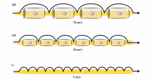An illustration of three nerve fibers demonstrating speed of conduction of each. Top: A-beta fiber has a conduction velocity of 70 m/s. Middle: A-delta fiber has a conduction velocity of 30 m/s. Bottom C fiber has a conduction velocity of 2 m/s