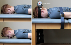 Three-panel photograph of a patient undergoing a neck extensor test. Patient is shown from the waist up, lateral view, lying face down on an examining table. The table has a hole that makes it possible for the patient to lie face down. Top left image: patient is lying at rest. Bottom left image: patient is holding his body in neutral extension, with his head lefted from the table so that his neck spine is held vertically with his chin retracted toward his neck. Right image: patient is lying at rest with his face in the table hole. He has a strap around his head that runs through the hole in the table, with a weight suspended from the the strap under the table. An inclinometer dial is attached to the top of his head.