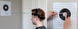Two-panel photo showing a patient ungdergoing a mean error test for proprioception. Left panel: Patient is shown from the neck up, lateral view. Patient is wearing a laser device strapped to his head, and is looking toward a circular target on the wall in front of him. The target has a grid overlay. The laser beam is directed at the center of the target. Right panel: A clinician's hands are shown measuring the distance between the centre of the target and a point to the left of centre.