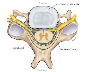 Illustration of a cervical vertebra and normal, unherniated intervertebral disc