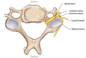 Illustration of a cervical vertebra (superior view) showing the exiting spinal nerve with anterior ramus and posterior ramus labelled. The posterior ramus divides into a lateral and medial branch
