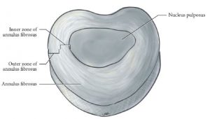 Illustration of fibrocartilaginous intervertebral disc showing nucleus pulposus, and zones of the annulus fibrosus