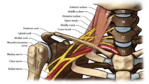 Illustration of right brachial plexus, anterior view, with nerves, muscles, cervical vertebrae, and subclavian artery all labelled
