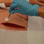 Dry wound edges with sterile gauze