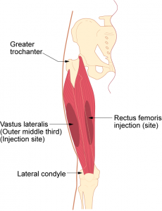 Vastus lateralis intramuscular injection site