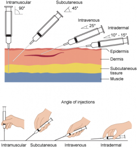 Insertion Angles. Intramuscular: 90°. Subcutaneous: 45°. Intravenous: 25°. Intradermal: 10°-15°.