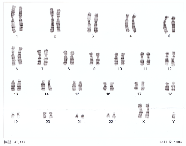images of the 23 pairs of chromosomes