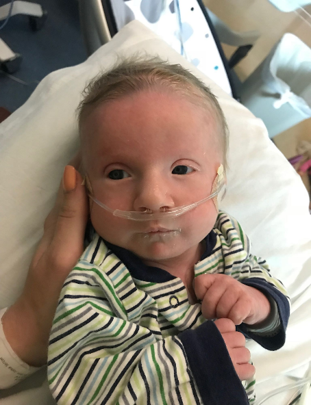 Images of an infant with Trisomy 9 Mosaicism