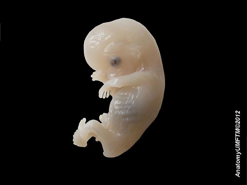 image of a human embryo