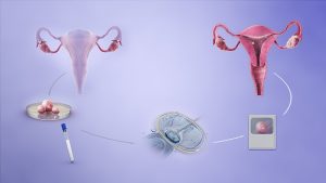 graphic of the in vitro fertilization process