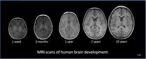 MRI scans of human brain development