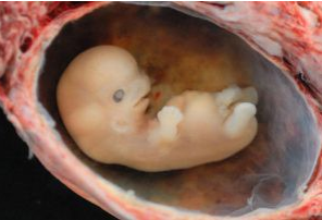 A tiny embryo (14 days) depicting some development of arms and legs, as well as facial features that are starting to show.
