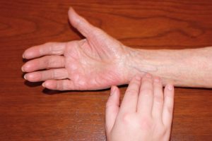 Healthcare provider placing fingers incorrectly on the ulnar side of wrist to take radial pulse