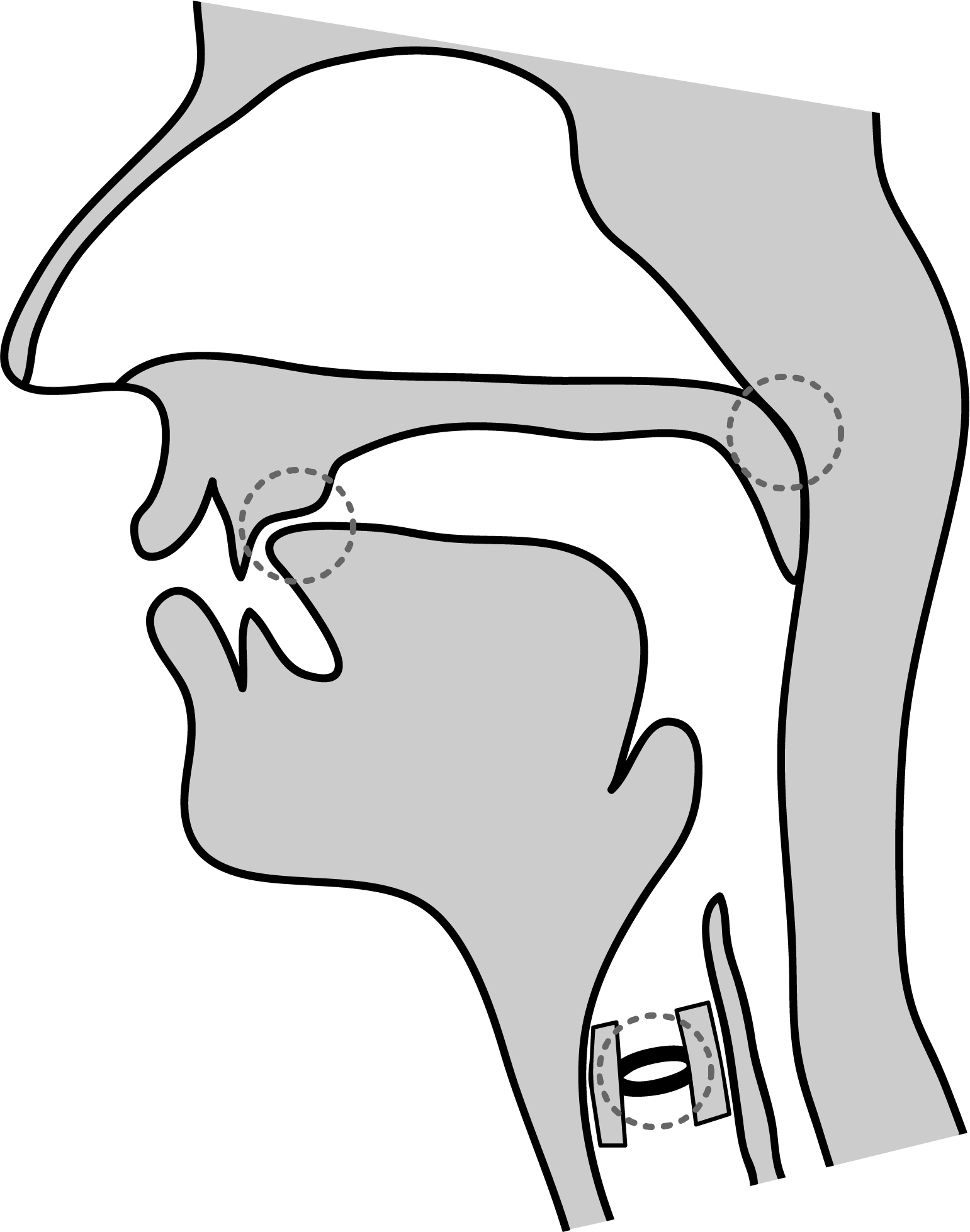 Midsagittal diagram showing the tongue front near the the alveolar ridge, the velum raised, and the vocal folds not vibrating.