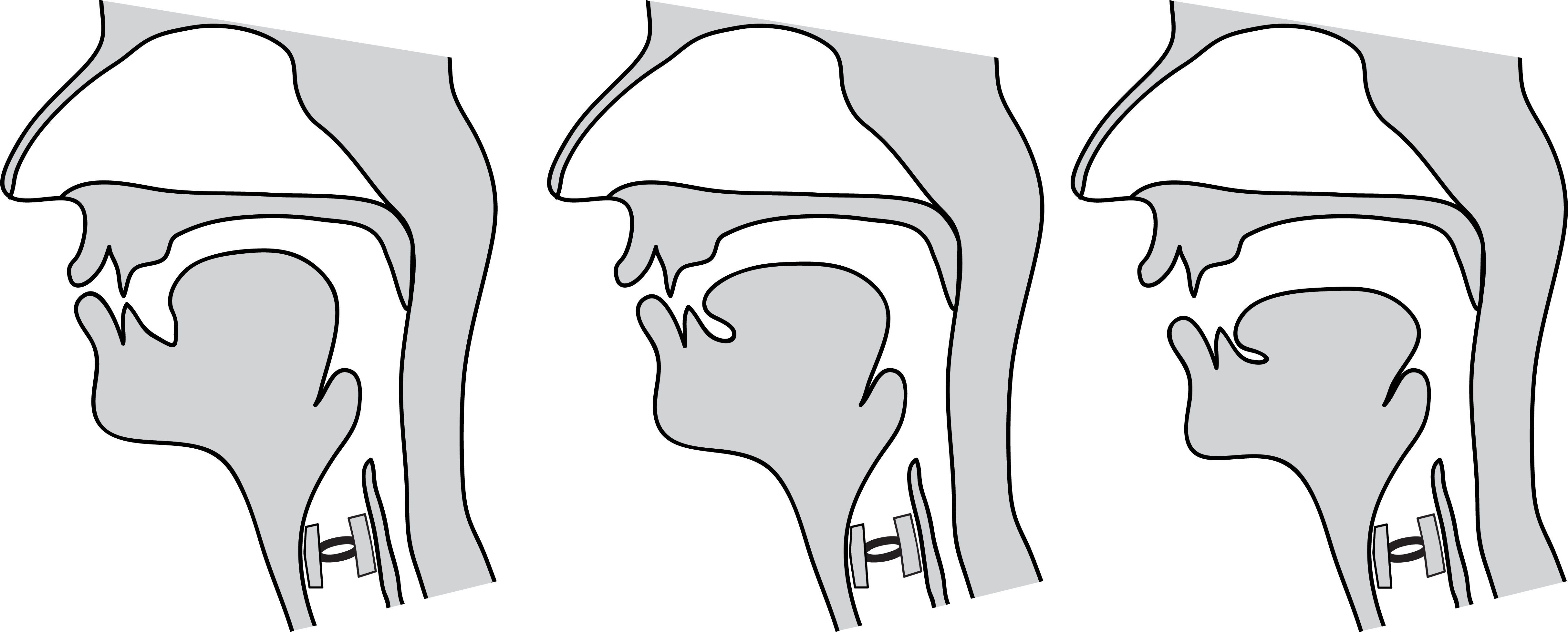 Three midsagittal diagrams, showing a high tongue position, a mid tongue position, and a low tongue position.