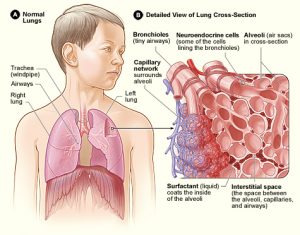A diagram of a person with lungs shown, plus a close up of alveoli and capillary network