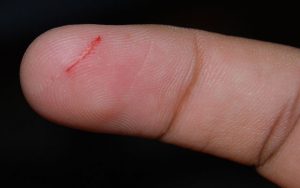 A papercut on a finger tip