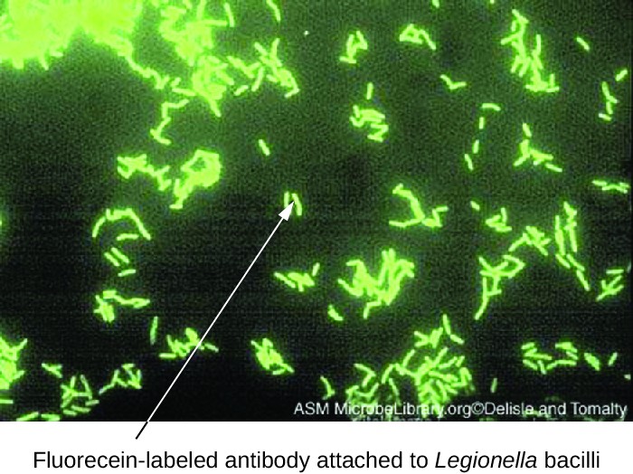 Fluorescence micrograph showing green fluorescent, rod-shaped bacteria in a patient's sputum sample