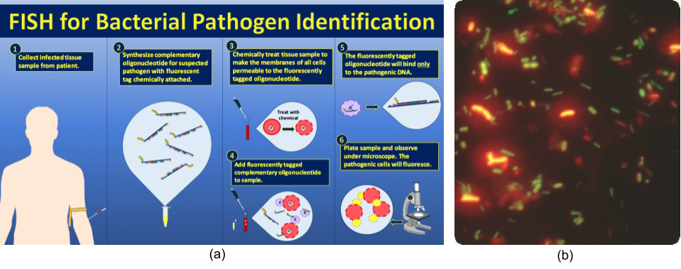 Figure 15. a) Procedure for fluorescence in situ hybridization (FISH) identification of bacterial pathogens. A patient tissue sample is first chemically treated to permeabilize the membrane. A fluorescently-tagged oligonucleotide complementary to the suspected pathogen’s rRNA gene is added to the tissue sample and, in the case of a positive identification, the probe will bind to the complementary DNA of the pathogen. Upon examination with the fluorescent microscope, the labeled cells will fluoresce. (b). Fluorescence microscopy of mixed bacterial sample. Bifidobacteria are identified by hybridization of Cy3-labeled probe (red) while FITC (green) stain binds all bacteria based on domain-level homology.