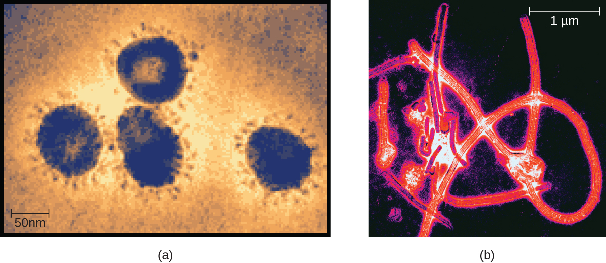 Figure A is an electron micrograph Coronavirus, showing spherical viral particles with many small projections protruding outwards. Figure B is an electron micrograph of the long, flexible filament-shaped particles of Ebolavirus.