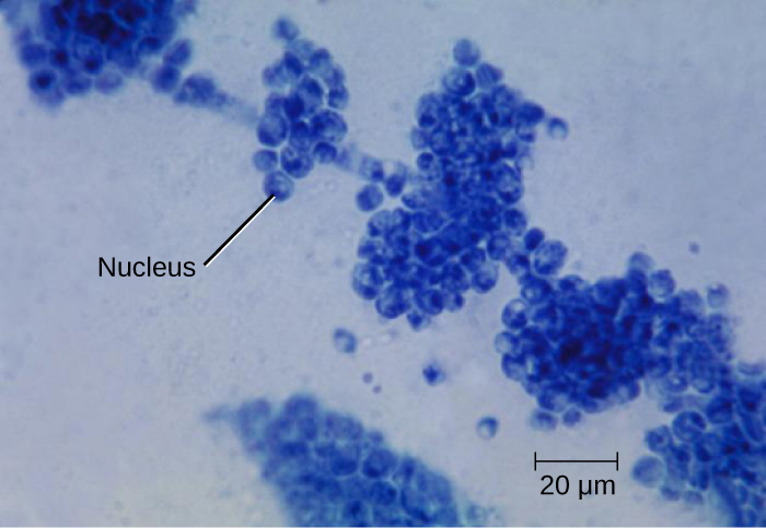 A light micrograph of yeast cells, stained blue. The species shown is a human pathogen, has a morphology similar to that of coccus bacteria, but is much larger. The nuclei of these eukaryotic cells are visible as dark centres within the cells..
