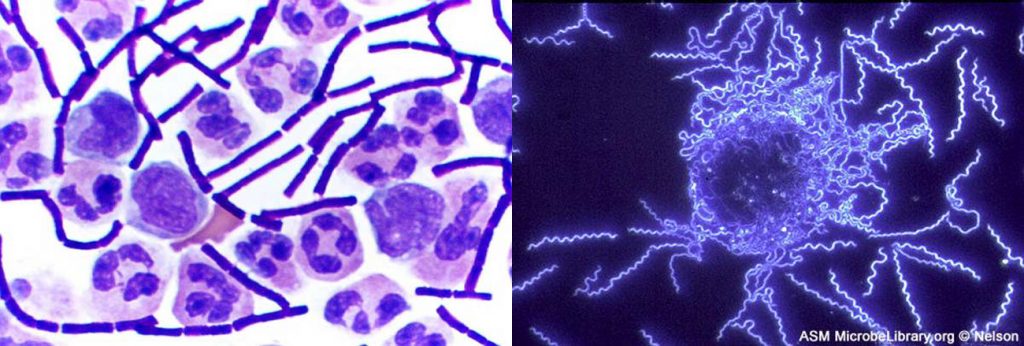 On the left, brightfield microscopy was used to visualize purple rods-shaped bacteria and larger stained white blood cells. The right image was taken using darkfield microscopy, and shows thin, brightly-lit spiral-shaped bacteria against a dark background.