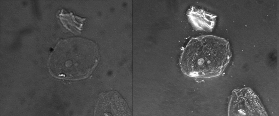 Two micrographs of a cell on a dark background are shown. In the brightfield image the cell is a faint circle with a small grey circle in the centre. In the phase-contrast image the cell is a bright circle with a bright circle in the centre.