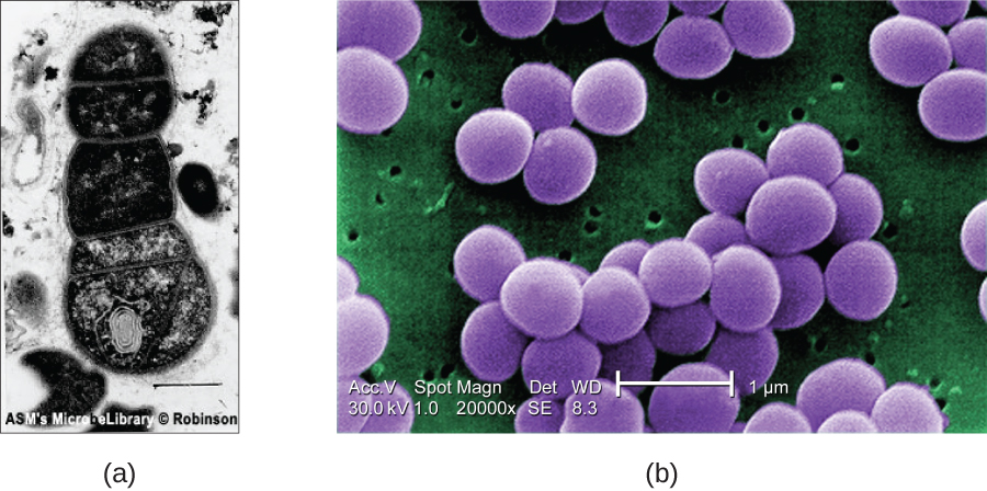 Figure a shows A TEM micrograph with a clear background and a dark cell in the centre. A double line outlines the edge of the cell and webs of material inside the cell are visible. Figure b shows an SEM micrograph that has large purple clusters on a green background with small holes. The three dimensionality of the purple clusters is apparent.