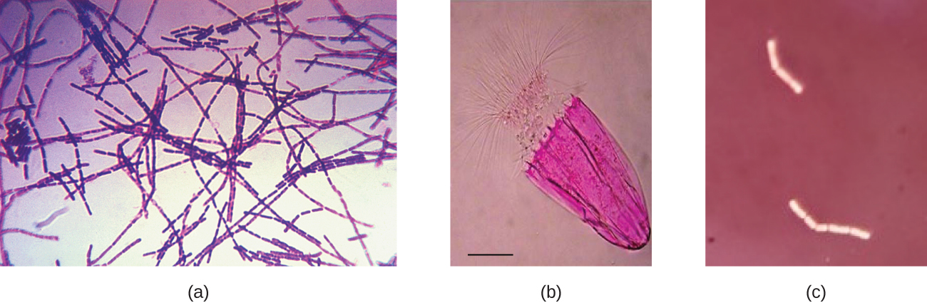 Staphylococcus aureus under microscope: microscopy of Gram-positive cocci,  morphology and microscopic appearance of Staphylococcus aureus, S.aureus  gram stain and colony morphology on agar, clinical significance