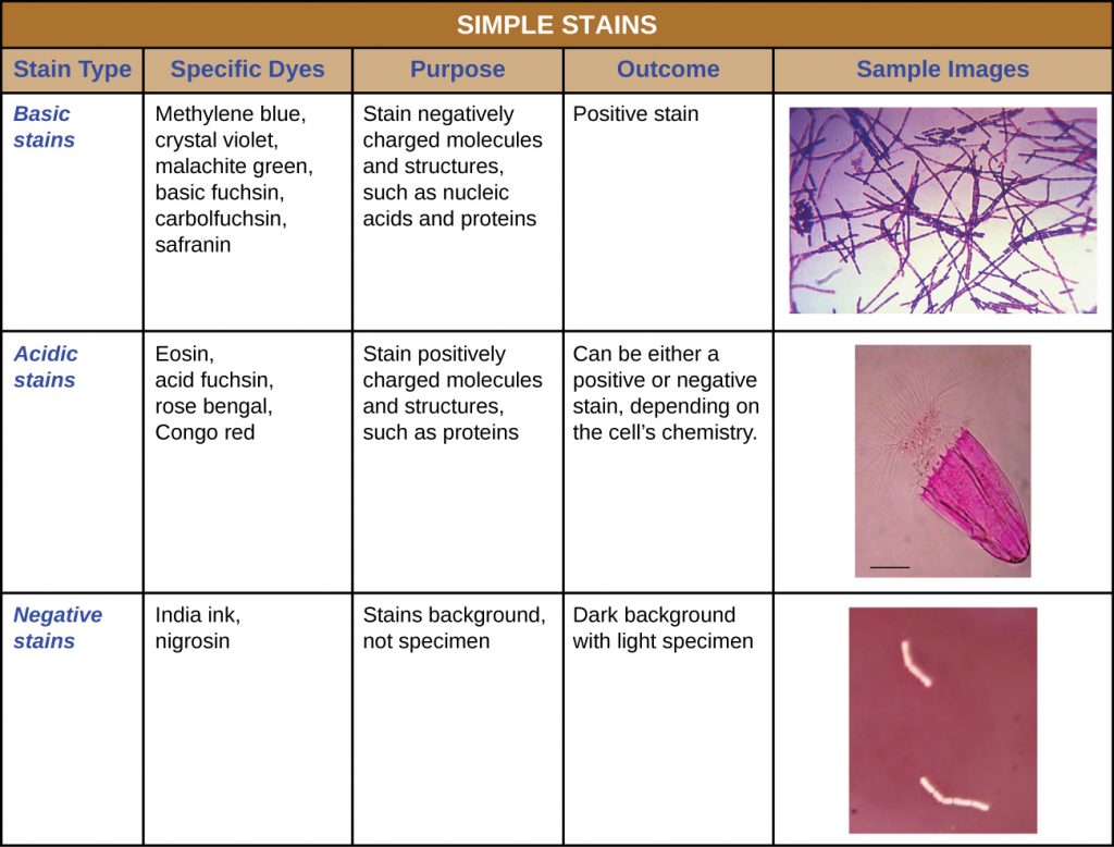 A table summarizing basic stains, acidic stains and negative stains.