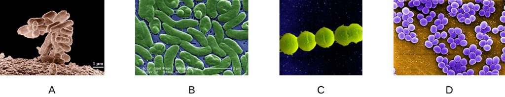 A) A micrograph of rods in a cluster. B) a micrograph of individual rods. C) A micrograph of spheres in a chain. D) a micrograph of spheres in a cluster.