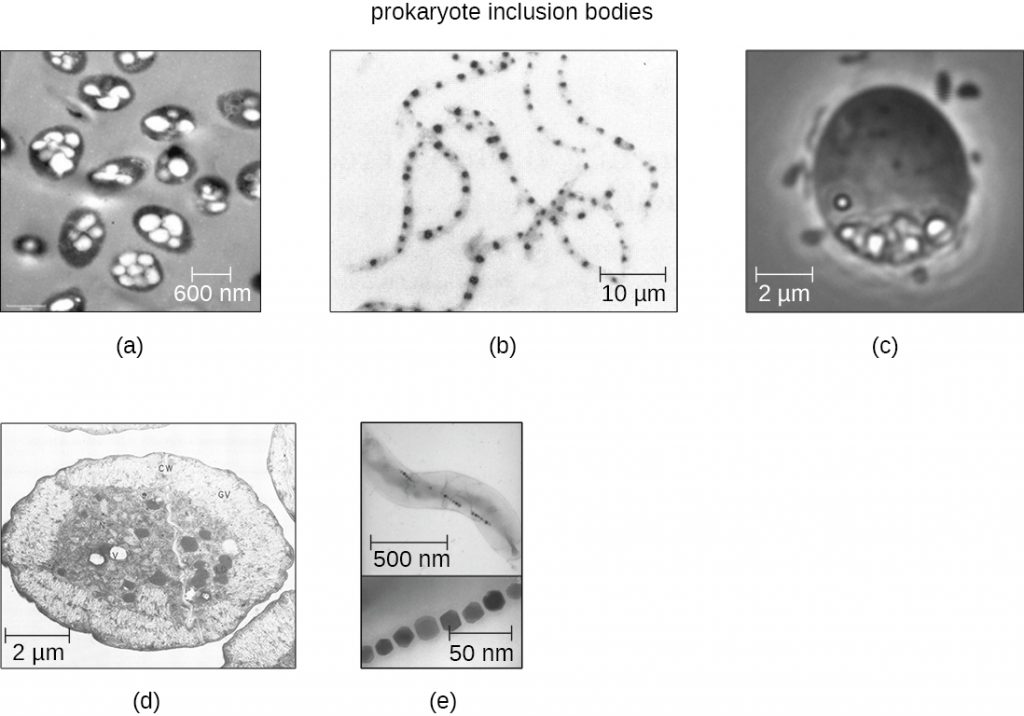 Electron micrographs of prokaryote inclusion bodies.