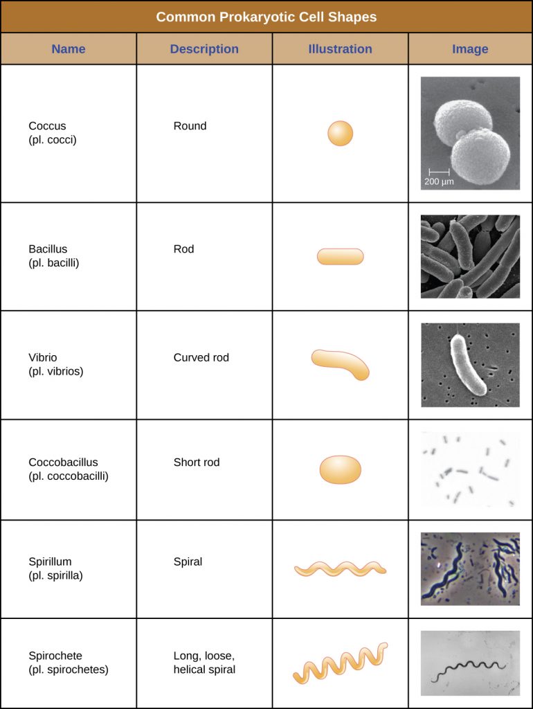 Example of prokaryotic cell