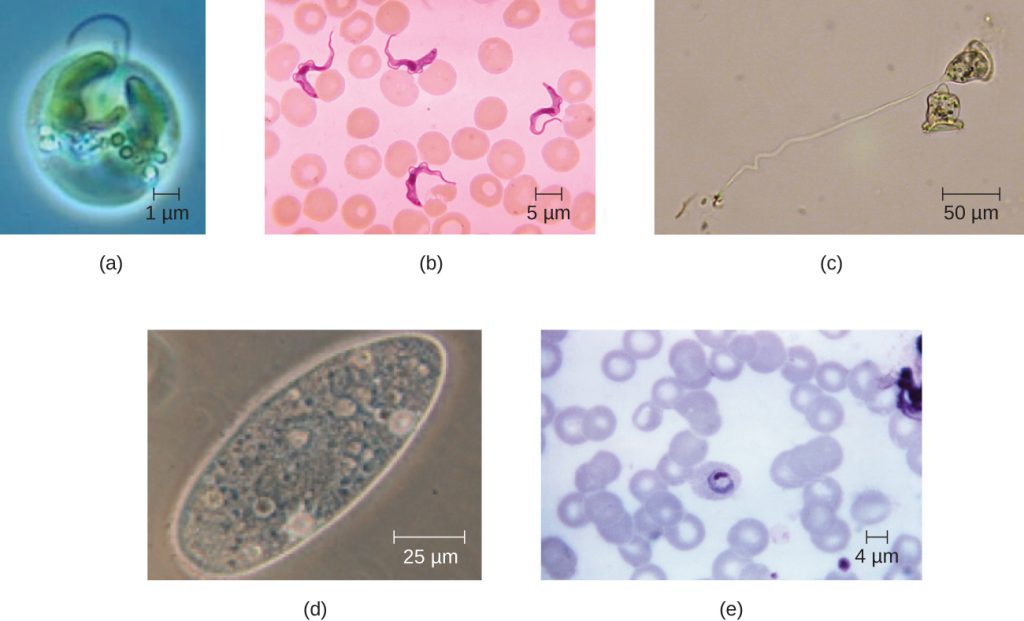Micrographs of various eukaryotic microorganisms that differ in cell shapes.