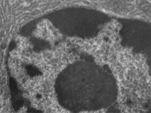 A micrograph of a portion of an oval cell. In the centre is a darker spherical structure.
