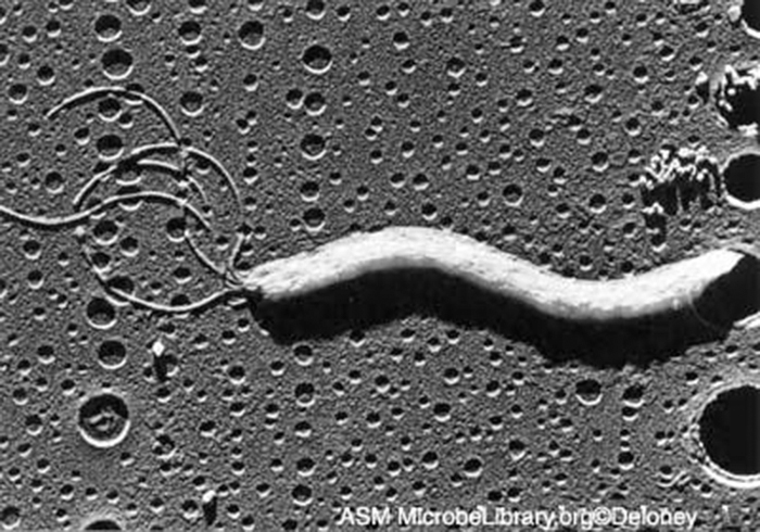 A micrograph of a rod shaped cell with many long projections.