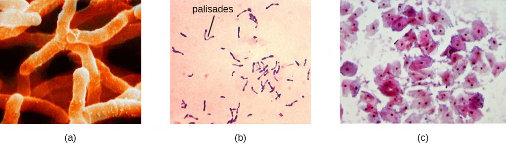 Staphylococcus aureus under microscope: microscopy of Gram-positive cocci,  morphology and microscopic appearance of Staphylococcus aureus, S.aureus  gram stain and colony morphology on agar, clinical significance