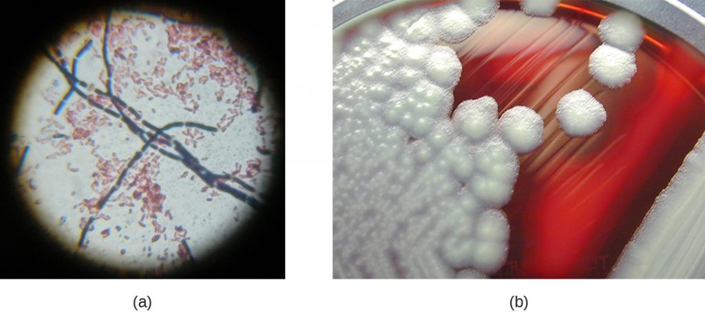 a) A micrograph of rod shaped cells in a chain. B) A photograph of colonies on agar. The agar is red and the colonies are white and fluffy looking.