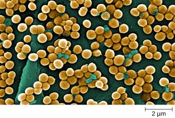 4.4 Gram-Positive Bacteria – Microbiology: Canadian Edition