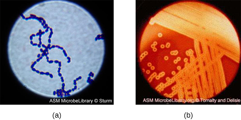 Staphylococcus aureus light microscopy. Morphology of Staphylococcus aureus  under the microscope. Micrograph of S.aureus, Gram stain. Gram-stained  smear from culture.