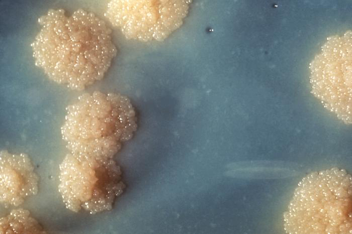 A photograph of colonies on agar. The agar is blue and the colonies look like a pile of beads.