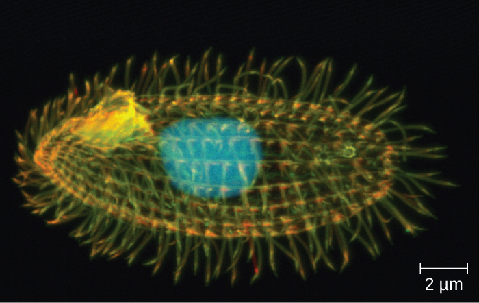 A micrograph of an oval cell with a large sphere in the centre and many short hair-like projections on the outside.