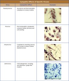 6.3 Isolation, Culture, and Identification of Viruses – Microbiology ...