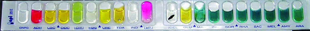 A strip with bubbles containing liquids. DNPG is clear. ADH is pink. LDC is yellow, ODC is yellow. Cit is green. H2S is clear. URE is yellow. TDA is yellow IND is white. VP is ping. GEL has a black streak. GLU is yellow. MA is green. IND is green. SOR is green. RHA is green. SAC is green. MEL is green. AMY is green ARA is green.
