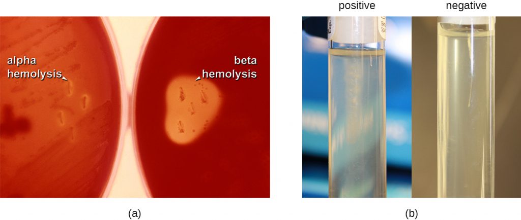 a) Two blood agar plates which have a red colour. The left plate is labeled alpha hemolysis and shows slight clearings around the colonies. The right plate is labeled beta hemolysis and shows complete clearings around the colonies. B) Two tubes. The left tube is positive and shows cloudiness spreading out from the central line down the middle of the tube. The right tube is negative and shows no cloudiness spreading out from this central line.