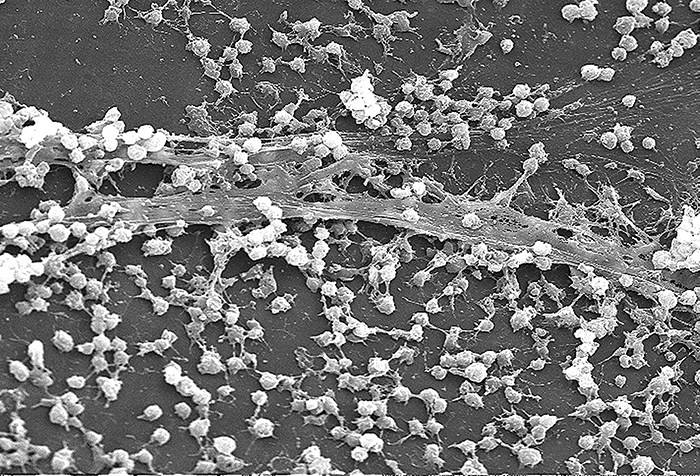 Scanning electron micrograph showing bacteria and their glycocalyx from a biofilm on a catheter