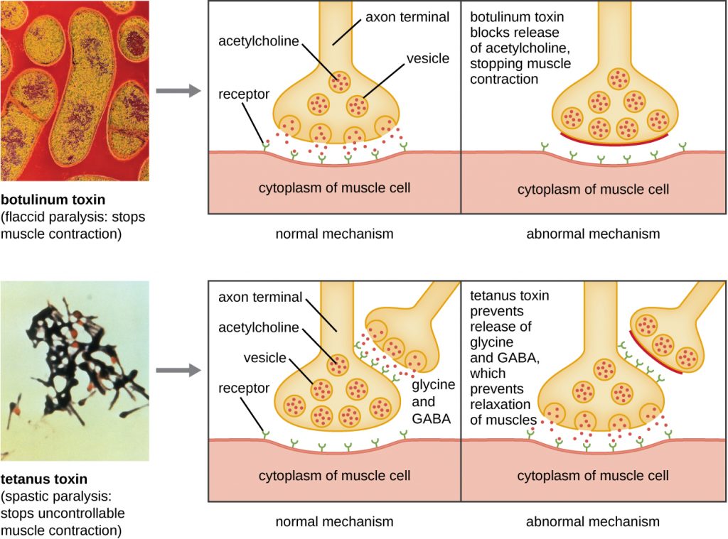 Diagram comparing the effects of botulinum and tetanus toxin.