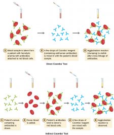 21.3 Agglutination Assays – Microbiology: Canadian Edition