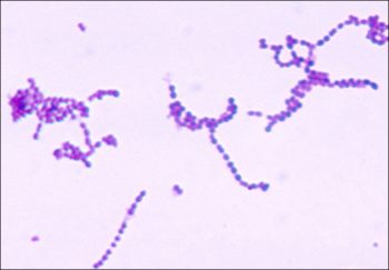 22.2 Bacterial Infections of the Skin and Eyes – Microbiology: Canadian ...