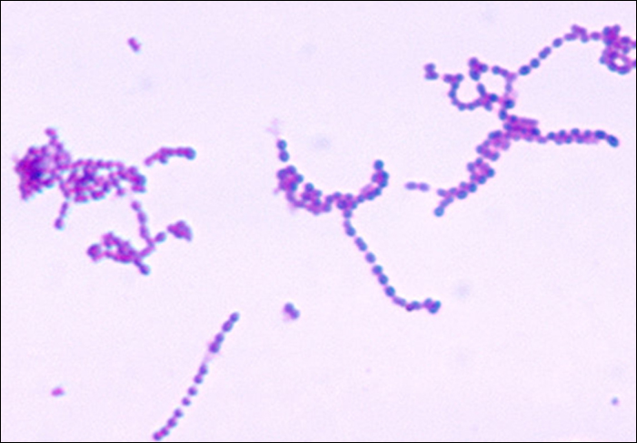 A micrograph of Streptococcus pyogenes is shown.